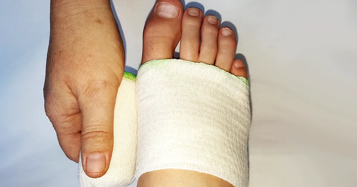 Twisted ankle in Trekking